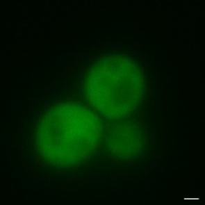 These yeast cells contain a prion protein that can change shape from a non-clumping form to one that aggregates into clumps called amyloids. Proteins in these cells have the non-clumping shape and are tagged with a marker that fluoresces green under UV light. (Photo courtesy of Serio laboratory/ UA molecular and cellular biology) These yeast cells contain a prion protein that can change shape from a non-clumping form to one that aggregates into clumps called amyloids. Proteins in these cells have the non-clumping shape and are tagged with a marker that fluoresces green under UV light. (Photo courtesy of Serio laboratory/ UA molecular and cellular biology)